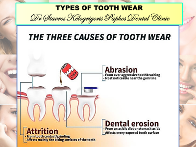 Dr Stavros Kelogrigoris Paphos Dental Clinic